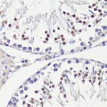 Immunohistochemistry - Anti-HFM1 Antibody (A10468) - Antibodies.com