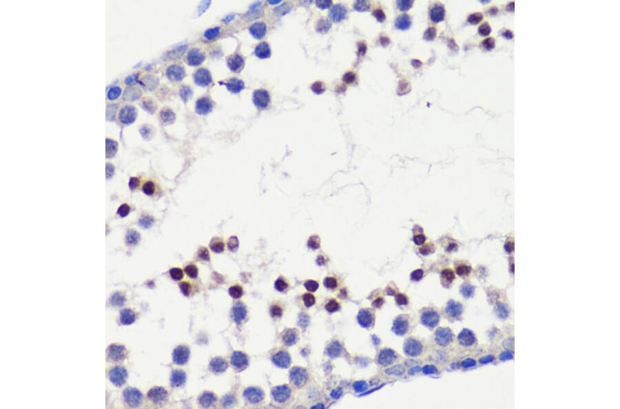 Immunohistochemistry - Anti-HFM1 Antibody (A10468) - Antibodies.com