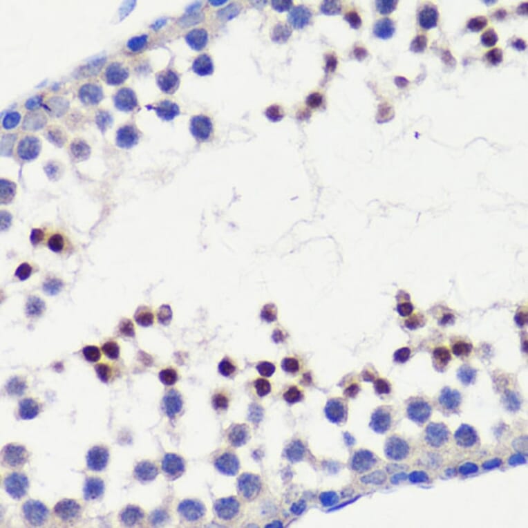 Immunohistochemistry - Anti-HFM1 Antibody (A10468) - Antibodies.com