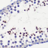 Immunohistochemistry - Anti-HFM1 Antibody (A10468) - Antibodies.com