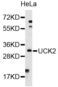 Western blot analysis of extracts of HeLa cells, using Anti-UCK2 Antibody (A8641).
Secondary antibody: Goat Anti-Rabbit IgG (H+L) (HRP) (AS014) at 1:10,000 dilution.
Lysates / proteins: 25µg per lane.
Blocking buffer: 3% non-fat dry milk in TBST.