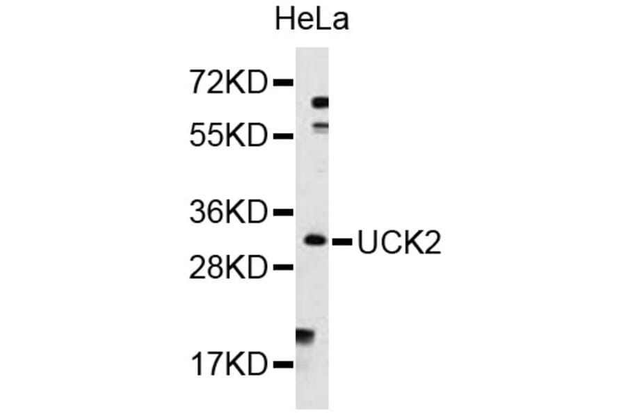 Western Blot - Anti-UCK2 Antibody (A8641) - Antibodies.com