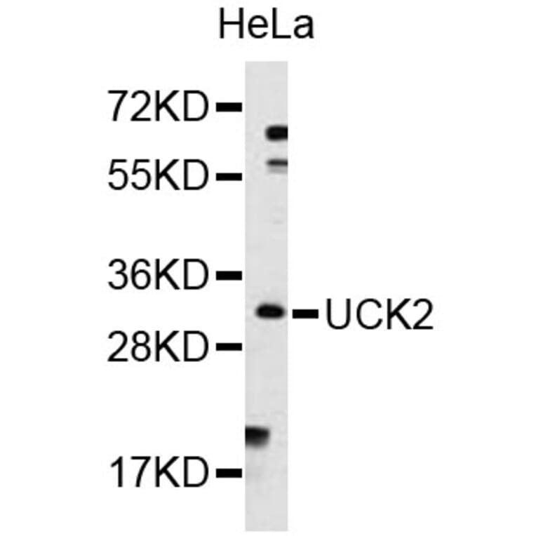 Western Blot - Anti-UCK2 Antibody (A8641) - Antibodies.com