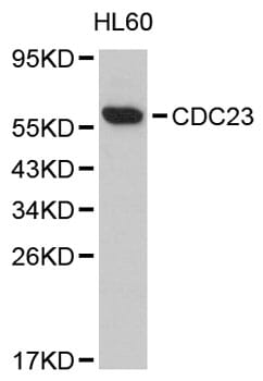 Western blot analysis of extracts of HL60 cells, using Anti-CDC23 Antibody (A8649).
Secondary antibody: Goat Anti-Rabbit IgG (H+L) (HRP) (AS014) at 1:10,000 dilution.
Lysates / proteins: 25µg per lane.
Blocking buffer: 3% non-fat dry milk in TBST.