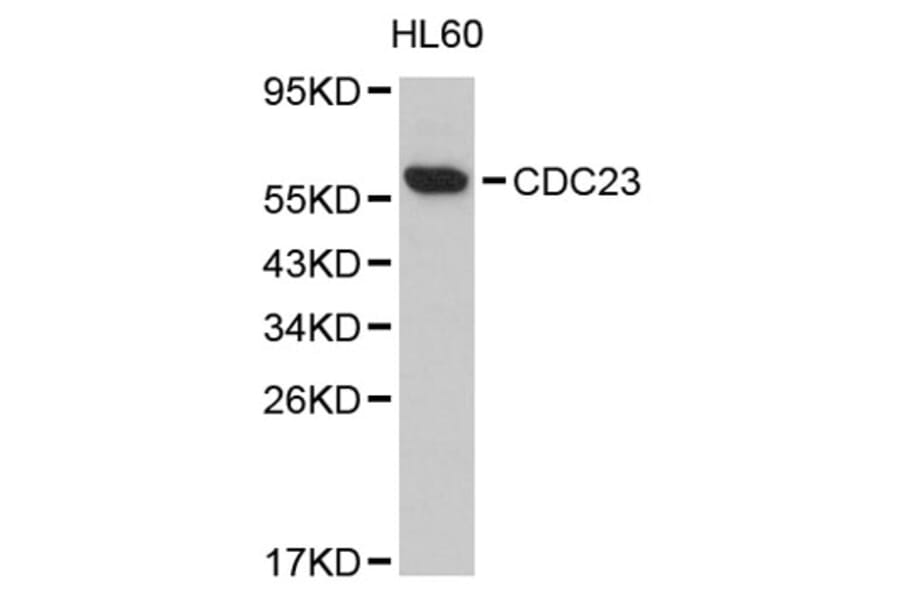 Western Blot - Anti-CDC23 Antibody (A8649) - Antibodies.com