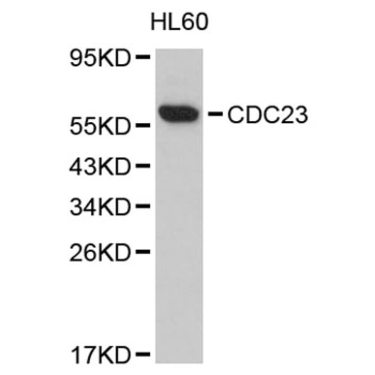 Western Blot - Anti-CDC23 Antibody (A8649) - Antibodies.com