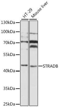 Western blot analysis of extracts of various cell lines, using Anti-STRADB Antibody (A8651) at 1:1,000 dilution.
Secondary antibody: Goat Anti-Rabbit IgG (H+L) (HRP) (AS014) at 1:10,000 dilution.
Lysates / proteins: 25µg per lane.
Blocking buffer: 3% non-fat dry milk in TBST.
Detection: ECL Basic Kit (RM00020).
Exposure time: 1s.