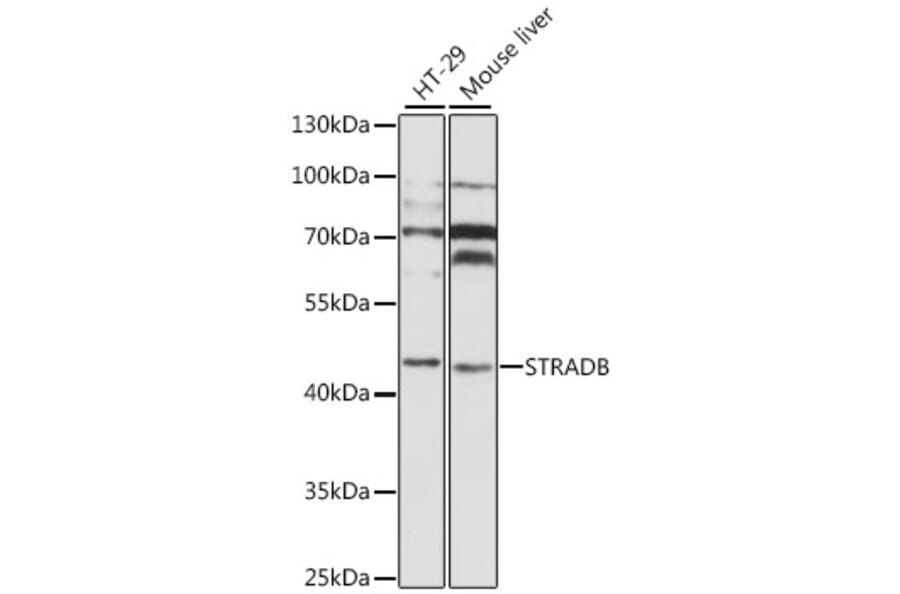 Western Blot - Anti-STRADB Antibody (A8651) - Antibodies.com