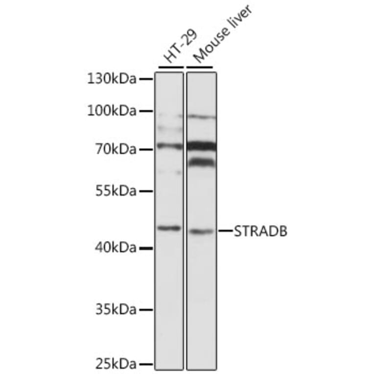 Western Blot - Anti-STRADB Antibody (A8651) - Antibodies.com