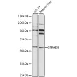 Western Blot - Anti-STRADB Antibody (A8651) - Antibodies.com