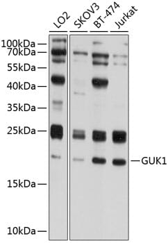 Western blot analysis of extracts of various cell lines, using Anti-GUK1 Antibody (A8656) at 1:1,000 dilution.
Secondary antibody: Goat Anti-Rabbit IgG (H+L) (HRP) (AS014) at 1:10,000 dilution.
Lysates / proteins: 25µg per lane.
Blocking buffer: 3% non-fat dry milk in TBST.
Detection: ECL Basic Kit (RM00020).
Exposure time: 1s.