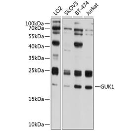 Western Blot - Anti-Guanylate kinase Antibody (A10484) - Antibodies.com