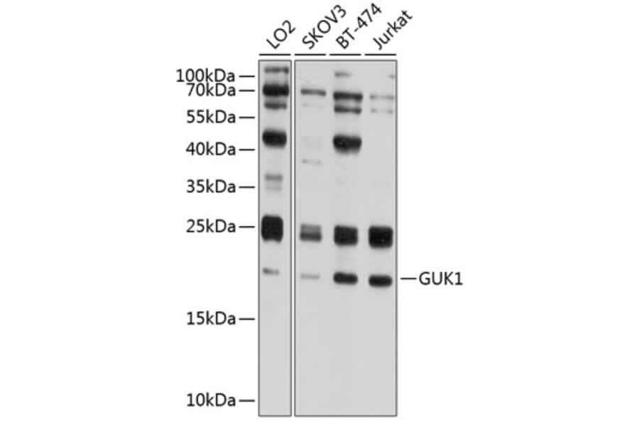 Western Blot - Anti-Guanylate kinase Antibody (A10484) - Antibodies.com
