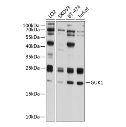 Western Blot - Anti-Guanylate kinase Antibody (A10484) - Antibodies.com