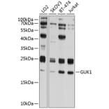 Western Blot - Anti-Guanylate kinase Antibody (A10484) - Antibodies.com