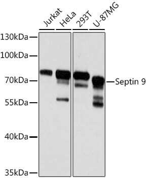 Western blot analysis of extracts of various cell lines, using Anti-SEPT9 Antibody (A8657) at 1:3000 dilution.
Secondary antibody: Goat Anti-Rabbit IgG (H+L) (HRP) (AS014) at 1:10,000 dilution.
Lysates / proteins: 25µg per lane.
Blocking buffer: 3% non-fat dry milk in TBST.
Detection: ECL Basic Kit (RM00020).
Exposure time: 5s.