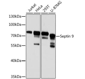Western Blot - Anti-MSF Antibody (A10485) - Antibodies.com