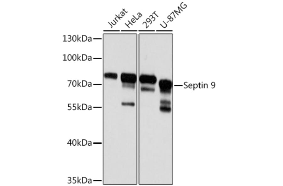 Western Blot - Anti-MSF Antibody (A10485) - Antibodies.com