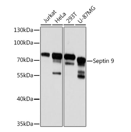 Western Blot - Anti-MSF Antibody (A10485) - Antibodies.com