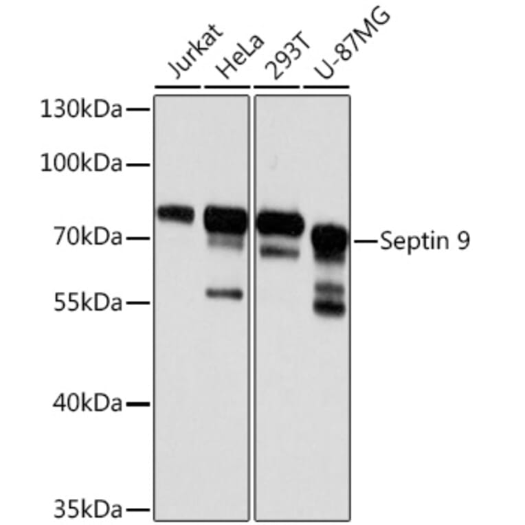 Western Blot - Anti-MSF Antibody (A10485) - Antibodies.com