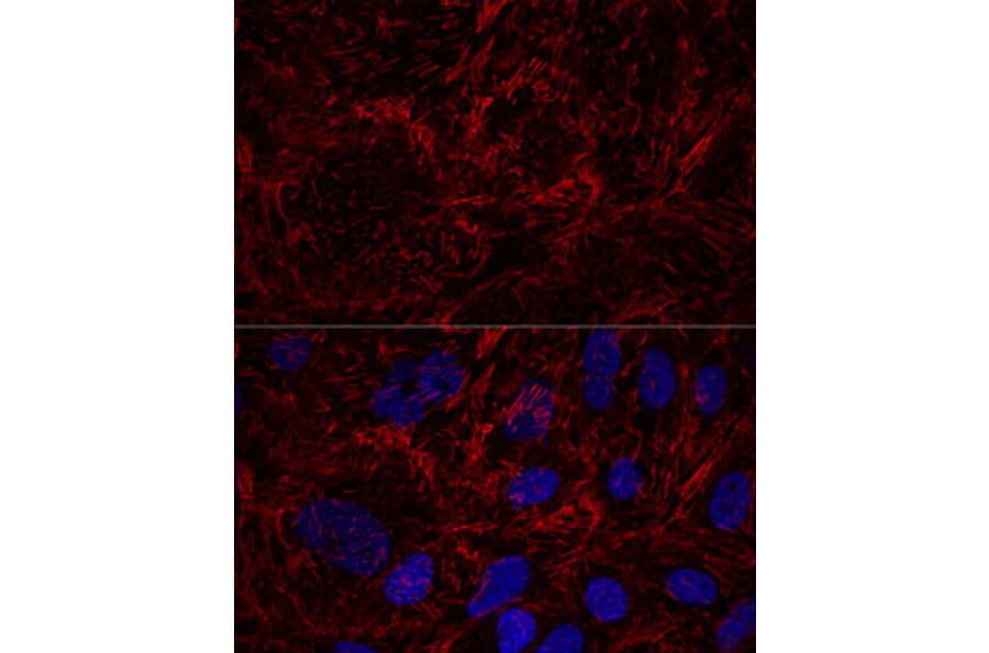 Immunofluorescence - Anti-MSF Antibody (A10485) - Antibodies.com