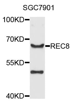 Western blot analysis of extracts of SGC-7901 cells, using Anti-REC8 Antibody (A8660) at 1:1,000 dilution.
Secondary antibody: Goat Anti-Rabbit IgG (H+L) (HRP) (AS014) at 1:10,000 dilution.
Lysates / proteins: 25µg per lane.
Blocking buffer: 3% non-fat dry milk in TBST.
Detection: ECL Basic Kit (RM00020).
Exposure time: 30s.