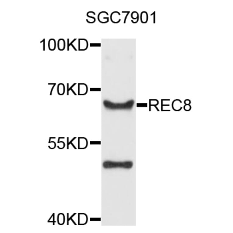 Western Blot - Anti-REC8 Antibody (A8660) - Antibodies.com