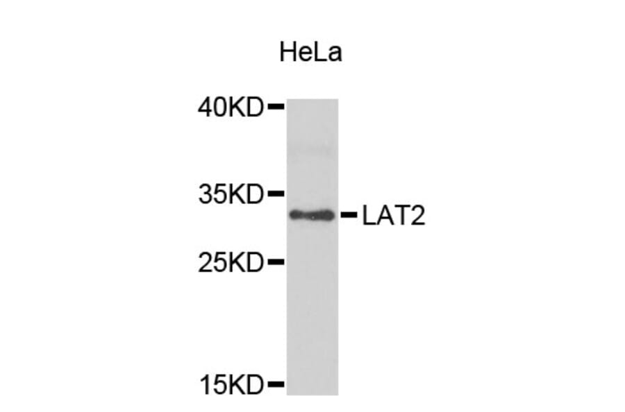 Western Blot - Anti-LAT2 Antibody (A8675) - Antibodies.com