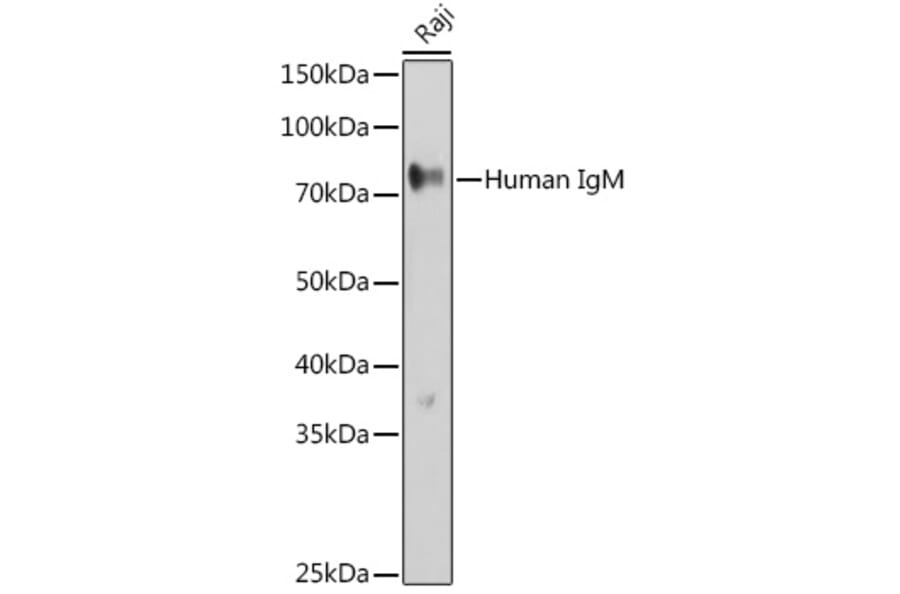 Western Blot - Anti-Human IgM Antibody (A10491) - Antibodies.com