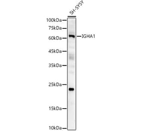 Western Blot - Anti-Human IgA Antibody (A10496) - Antibodies.com