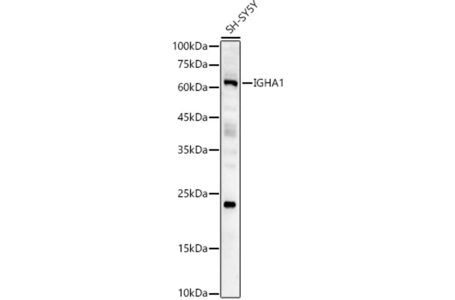 Western Blot - Anti-Human IgA Antibody (A10496) - Antibodies.com