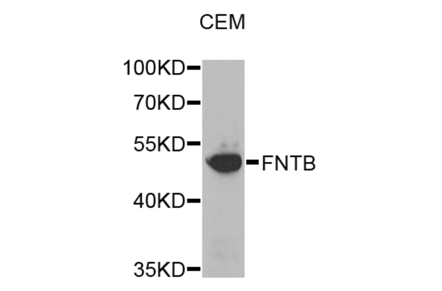 Western Blot - Anti-FNTB Antibody (A8717) - Antibodies.com
