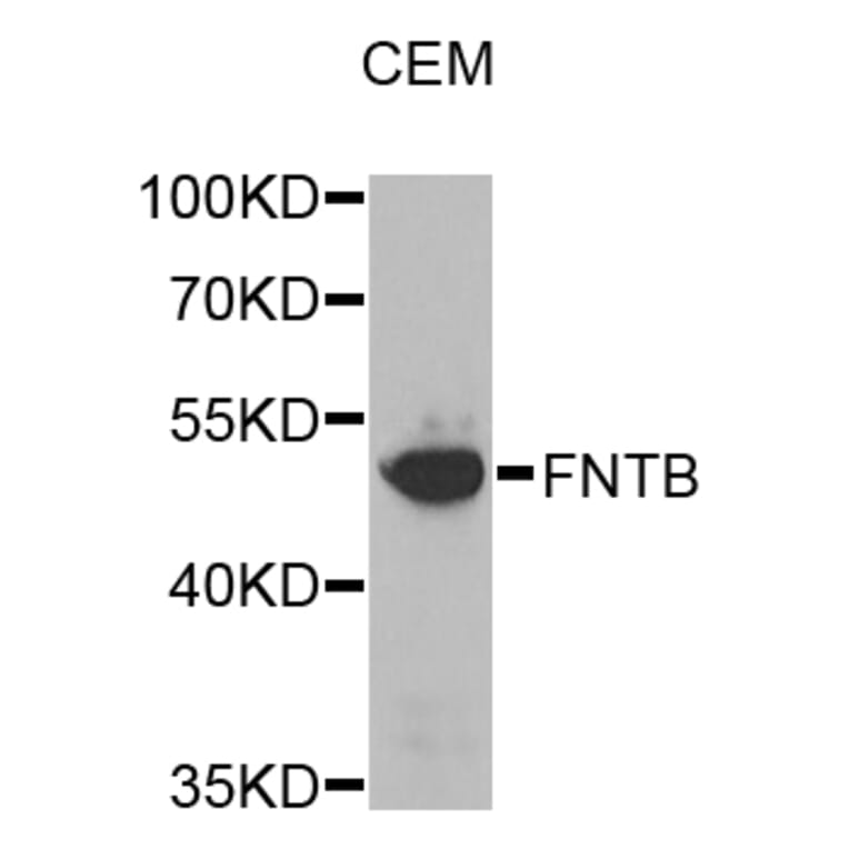 Western Blot - Anti-FNTB Antibody (A8717) - Antibodies.com
