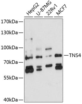 Western blot analysis of extracts of various cell lines, using Anti-TNS4 Antibody (A8731) at 1:3000 dilution. Secondary antibody: Goat Anti-Rabbit IgG (H+L) (HRP) (AS014) at 1:10,000 dilution. Lysates / proteins: 25µg per lane. Blocking buffer: 3% non-fat dry milk in TBST. Detection: ECL Enhanced Kit (RM00021). Exposure time: 90s.