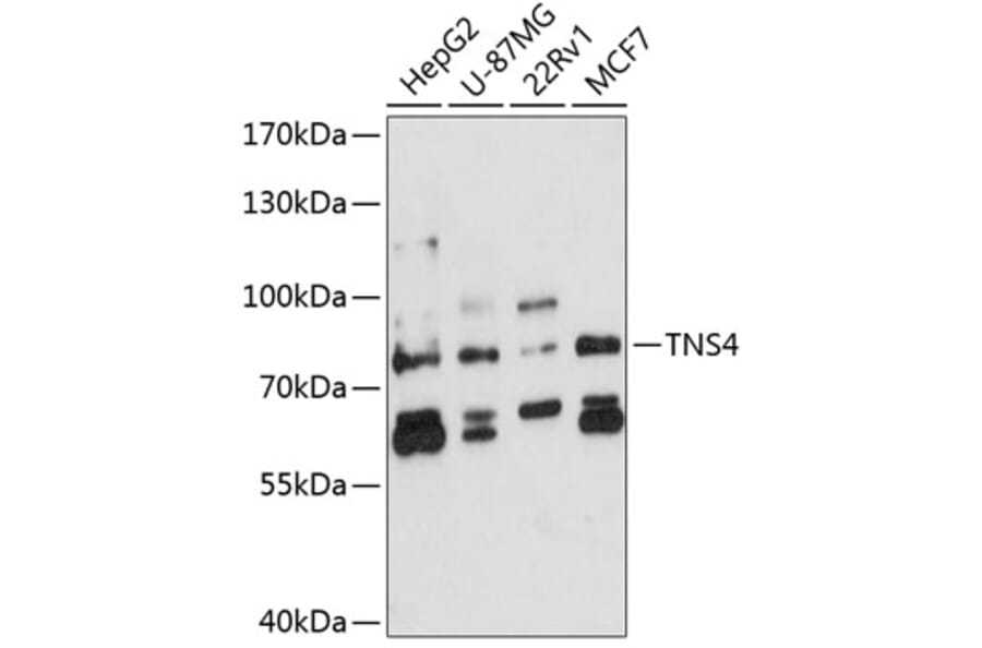 Western Blot - Anti-TNS4/CTEN Antibody (A10499) - Antibodies.com