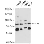 Western Blot - Anti-TNS4/CTEN Antibody (A10499) - Antibodies.com