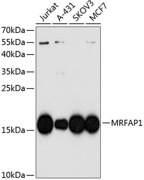 Western blot analysis of extracts of various cell lines, using Anti-MRFAP1 Antibody (A8739) at 1:1,000 dilution.
Secondary antibody: Goat Anti-Rabbit IgG (H+L) (HRP) (AS014) at 1:10,000 dilution.
Lysates / proteins: 25µg per lane.
Blocking buffer: 3% non-fat dry milk in TBST.
Detection: ECL Basic Kit (RM00020).
Exposure time: 60s.