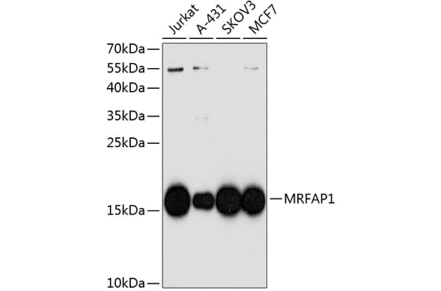 Western Blot - Anti-MRFAP1 Antibody (A10501) - Antibodies.com