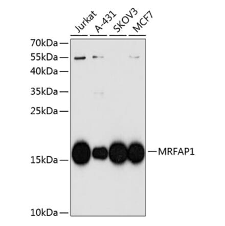 Western Blot - Anti-MRFAP1 Antibody (A10501) - Antibodies.com
