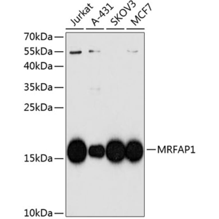 Western Blot - Anti-MRFAP1 Antibody (A10501) - Antibodies.com