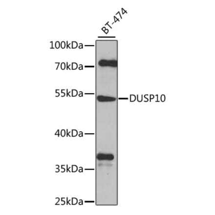 Western Blot - Anti-DUSP10 Antibody (A10502) - Antibodies.com