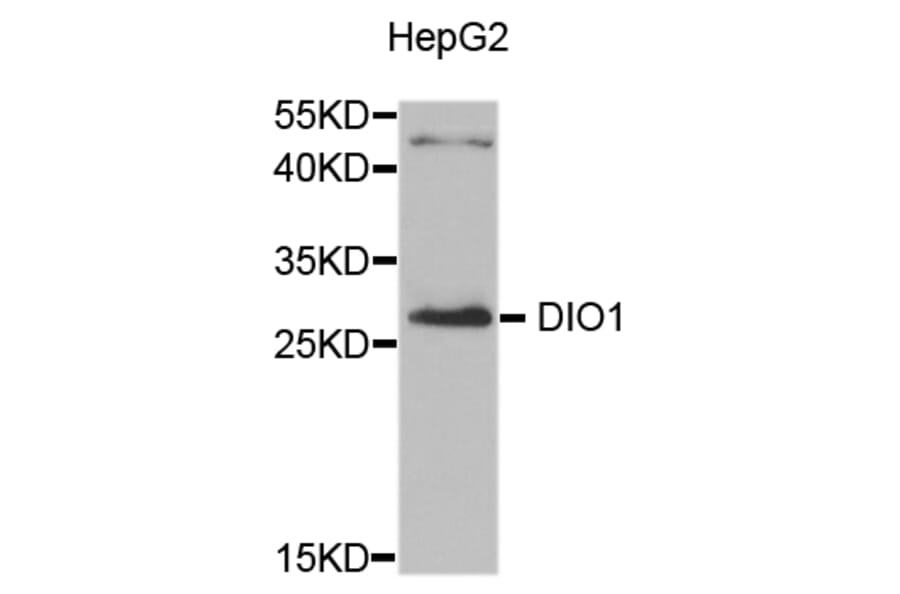 Western Blot - Anti-DIO1 Antibody (A8761) - Antibodies.com