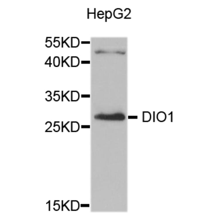 Western Blot - Anti-DIO1 Antibody (A8761) - Antibodies.com
