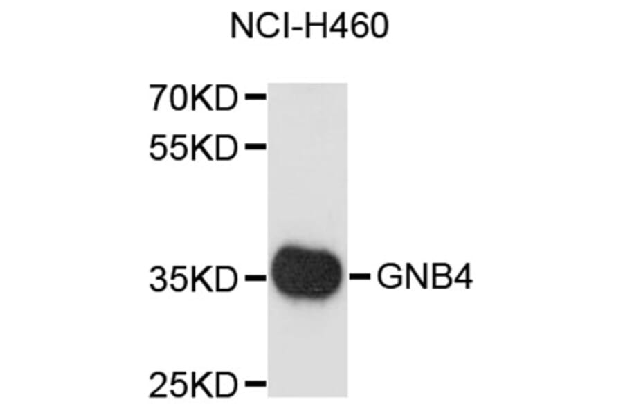 Western Blot - Anti-GNB4 Antibody (A8774) - Antibodies.com