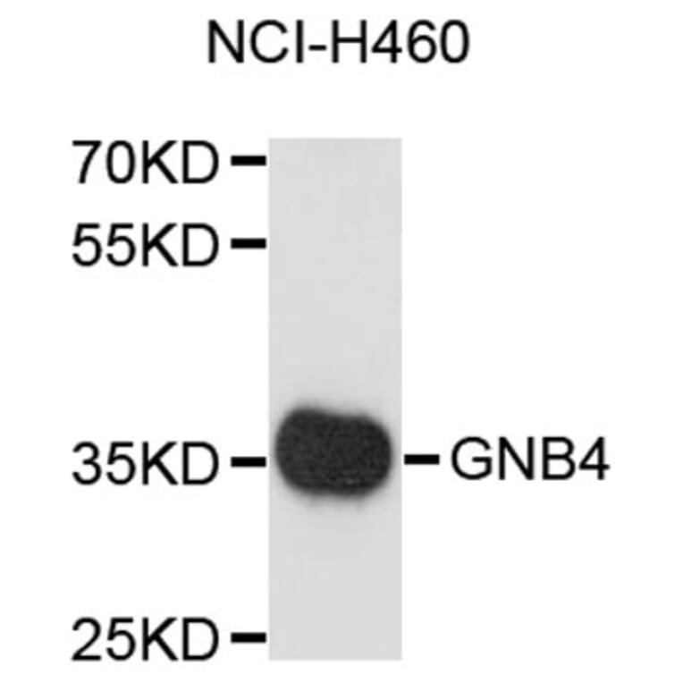 Western Blot - Anti-GNB4 Antibody (A8774) - Antibodies.com