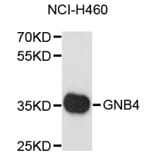 Western Blot - Anti-GNB4 Antibody (A8774) - Antibodies.com
