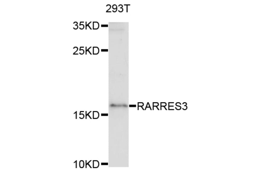 Western Blot - Anti-RARRES3 Antibody (A8784) - Antibodies.com