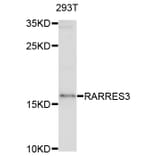 Western Blot - Anti-RARRES3 Antibody (A8784) - Antibodies.com