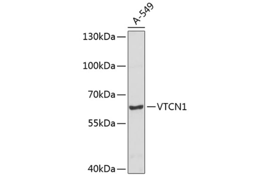 Western Blot - Anti-VTCN1 Antibody (A8786) - Antibodies.com