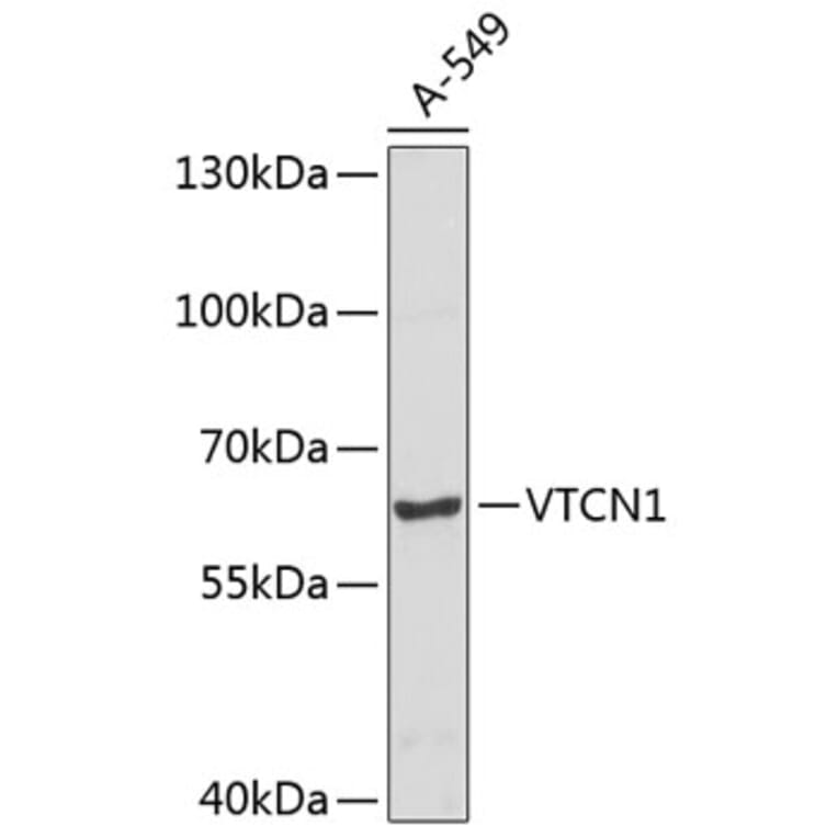 Western Blot - Anti-VTCN1 Antibody (A8786) - Antibodies.com